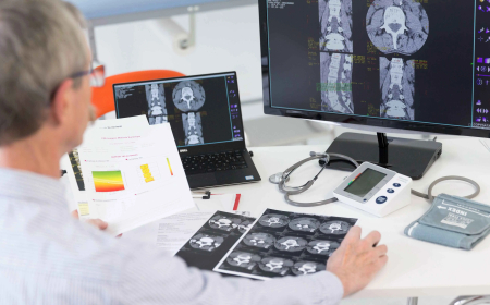 "المادة البيضاء" قد تمهد لعلاج فاعل لإصابات الحبل الشوكي