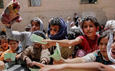 الأمم المتحدة: سوء التغذية يتفاقم في مناطق سيطرة الحكومة اليمنية