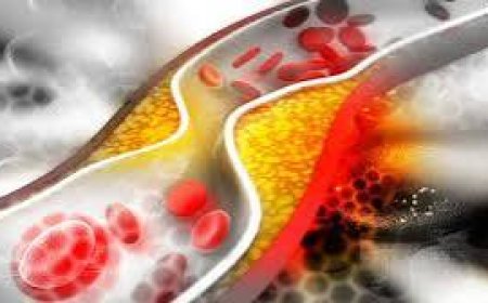 6 عادات يومية لخفض مستويات الكوليسترول بشكل طبيعي