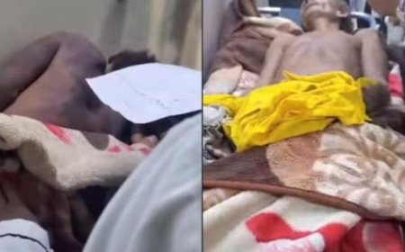 رايتس رادار تدين قتل مليشيا الحوثي لمسن بالحديدة