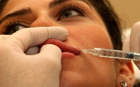 كأنها عفريتة..  زوج  يطلق زوجته بسبب الفيلر