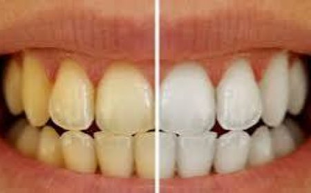 ما علاقة تغير لون الأسنان بمشاكل الكبد؟