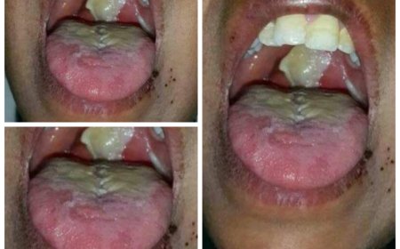 مديرة التثقيف والاعلام الصحي بعدن تدق ناقوس الخطر من انتشار مرض الدفتيريا بين الأطفال