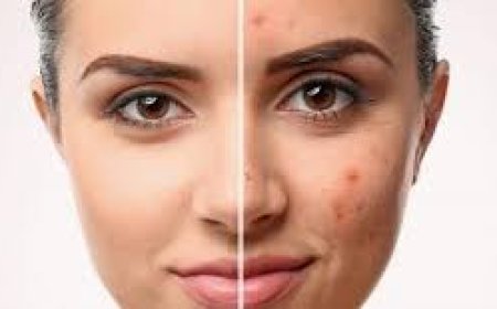 علامات على الوجه قد تدل على مشاكل في صحتك