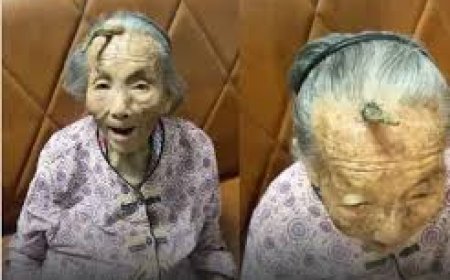 "قرن طول العمر".. على جبهة معمرة  تبلغ 107 أعوام