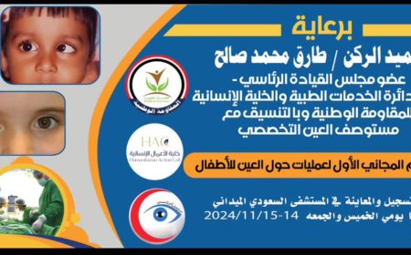 برعاية العميد طارق صالح.. مخيم مجاني لعمليات حول العين للأطفال في المخا