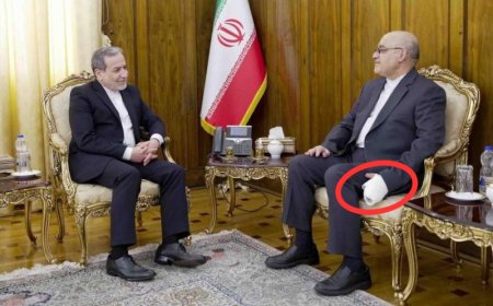 مبتور الأصابع ومصاب العين.. أول ظهور للسفير الإيراني في لبنان عقب إصابته بالبيجر ( صور)