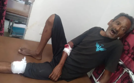 مجددا.. الحوثيون يقصفون تجمع للمواطنين في تعز.. حصيلة
