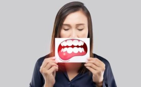 اذا كنت تعاني من إلتهاب اللثة .  اليك افضل طريقة لعلاجها في المنزل