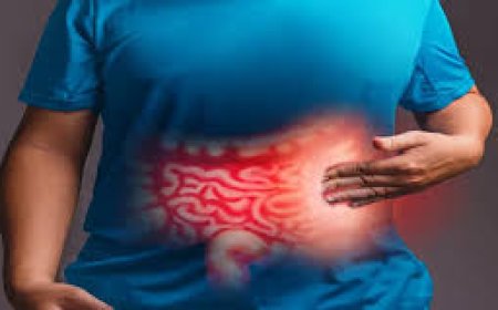 أطعمة ممنوعة لمرضى القولون العصبي.. تعرف عليها