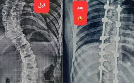 إنجاز طبي غير مسبوق في العاصمة عدن بطله الترك