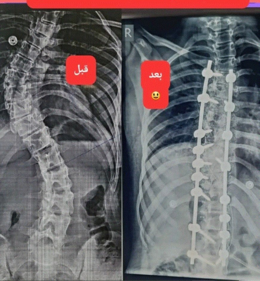 إنجاز طبي غير مسبوق في العاصمة عدن بطله الترك