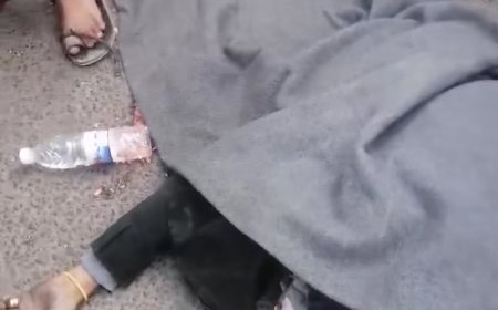 حادث مؤلم.. وفاة شاب بطريقة مأساوية في إب (صورة)