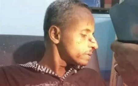 مقتل وإصابة ثلاثة أشخاص في إطلاق نار بسوق في تعز