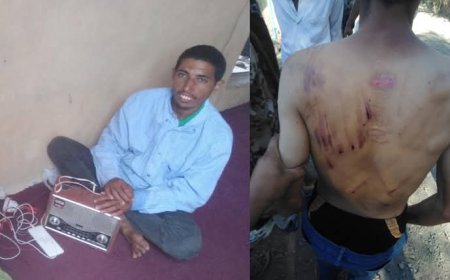 تعز.. معاق يتعرض للإعتداء من أحد أقاربه في "المعافر" ومطالبات مجتمعية بضبط المتهم