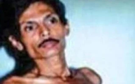 بعد 36 عاما .. اكتشف أنه يحمل توأمه .. ( تفاصيل الحكاية )