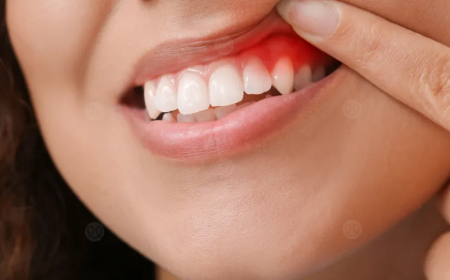 الالام اللثة.. أسبابها و اعراضها و كيفية علاجها في المنزل