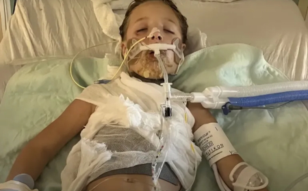 طفلة تصاب  بحروق خطيرة  و تدخل في غيبوبة بسبب تحدي في التيك توك !