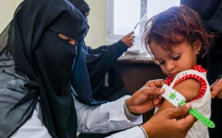 يونيسف تحصل على منحة ألمانية بقيمة 19.8 مليون يورو لمكافحة سوء التغذية باليمن