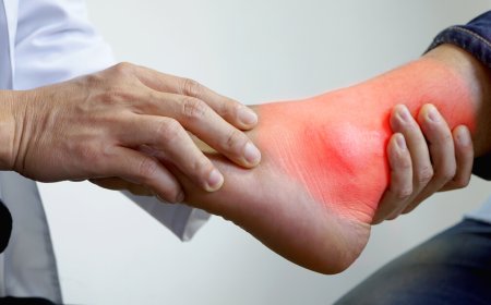 إليك نصائح  تخفض بها  حمض اليوريك في جسدك حتى لا تصاب بالنقرس