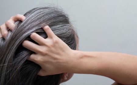 تخاف من شيب الشعر .. إليك هذه الأطعمة التي تقلل من ظهوره