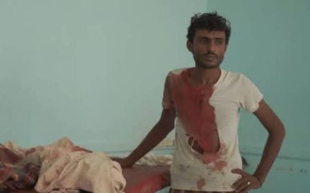 مجزرة جديدة للحوثيين في حيس تودي بحياة ثلاثة أطفال من عائلة واحدة