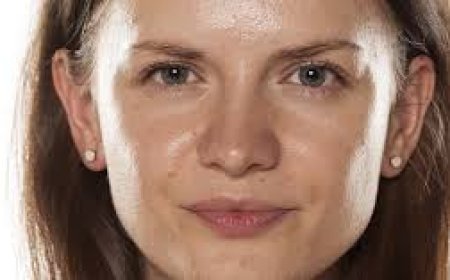 بشرتك دهنية .. إليكِ افضل الحلول لتقليل إفراز الدهون فصل الصيف