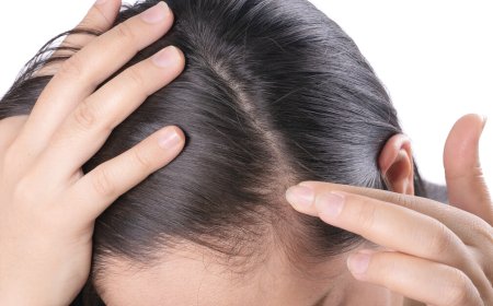 بطء نمو الشعر .. الأسباب و العلاجات