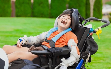 اسباب الإصابة بالشلل الدماغي.. تعرف عليها