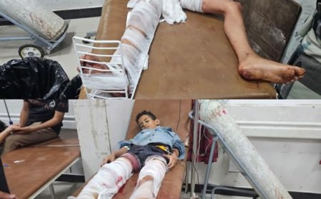 إصابة طفلين برصاص قناص حوثي في تعز