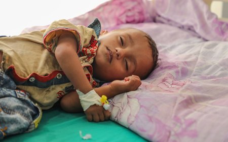 "الغذاء العالمي" يعلن وقف برنامج علاج سوء التغذية الحاد في مناطق سيطرة الحوثيين