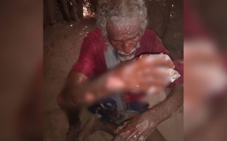 وفاة طفلة وإصابة أفراد من أسرتها جراء حريق التهم مسكنهم في الحديدة