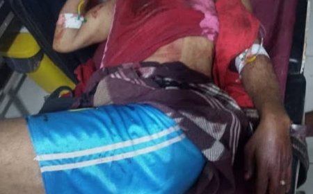 محاولة ذبح مواطن من قبل مجهولين في تعز