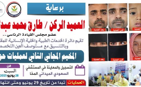 برعاية العميد الركن طارق صالح.. الإعلان عن المخيم المجاني الثاني لجراحة حول العين في المخاء
