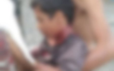 إصابة طفل برصاص قناصة حوثي في لحج