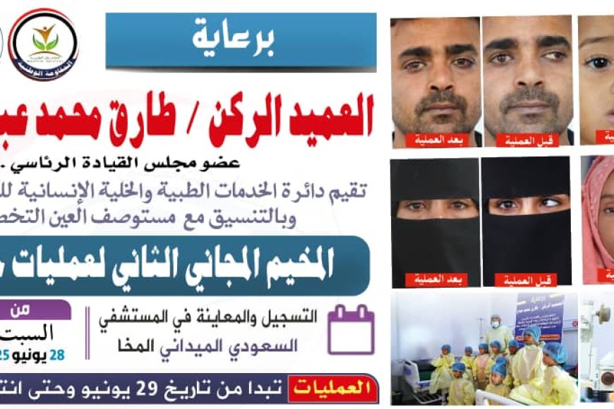 برعاية العميد الركن طارق صالح.. الإعلان عن المخيم المجاني الثاني لجراحة حول العين في المخاء