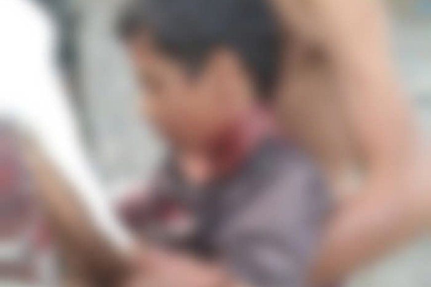 إصابة طفل برصاص قناصة حوثي في لحج