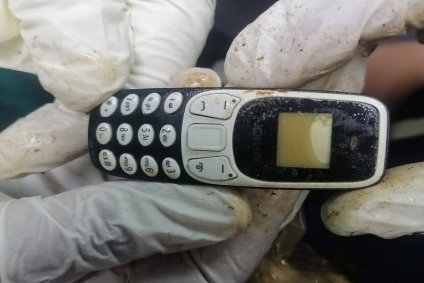 في بلد عربي ..استخرج هاتف من معدة شاب ابتلعه قبل عامين