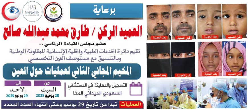 برعاية العميد الركن طارق صالح.. الإعلان عن المخيم المجاني الثاني لجراحة حول العين في المخاء