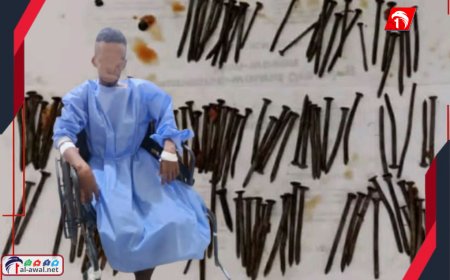 حادثة طبية مرعبة!.. بـ(117) مسمارًا أطباء عدن كانوا في سباق مع الموت لإنقاذ شاب