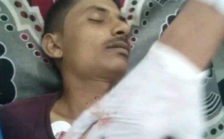 تعز.. جريمة وحشية تهز عزلة الأخمور