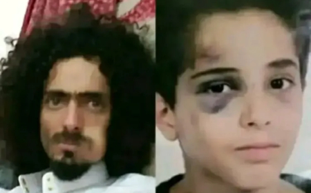 القصة الكاملة.. تحول جريمة اعتداء وحشي على طفل إلى قضية رأي عام بصنعاء