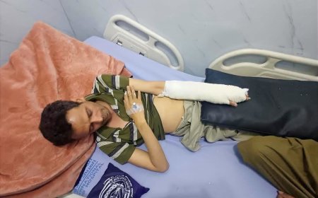 صنعاء.. عصابة تعتدي على ناشط حوثي تحدث عن فساد قيادات الحوثيين