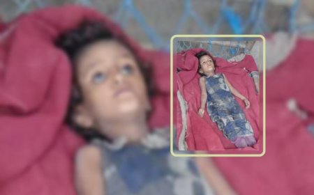 الجوع يفتك بطفلة نازحة في حجة في ظل نهب الحوثيين للمساعدات