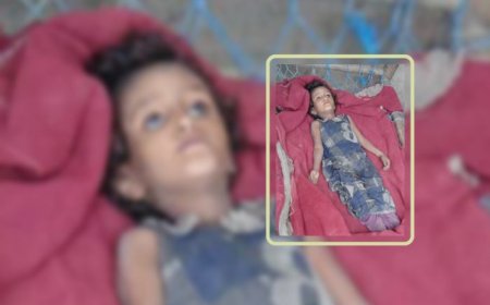 صحفي استقصائي يفضح محاولة حوثية لتزييف وفاة الطفلة أشواق جوعًا