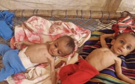 ظهور بؤرة للمجاعة في مناطق سيطرة الانقلابيين