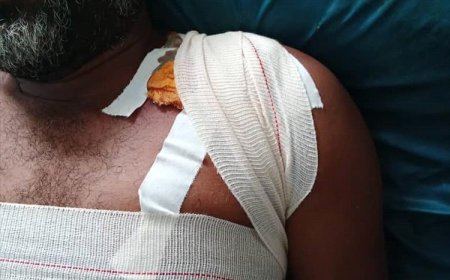 مشهد يتكرر يهدد الاستثمار وحياة منتسبيه  ..إصابة شخصين في اعتداء مسلح على حافلة موظفي مصنع أسمنت الوحدة في باتيس