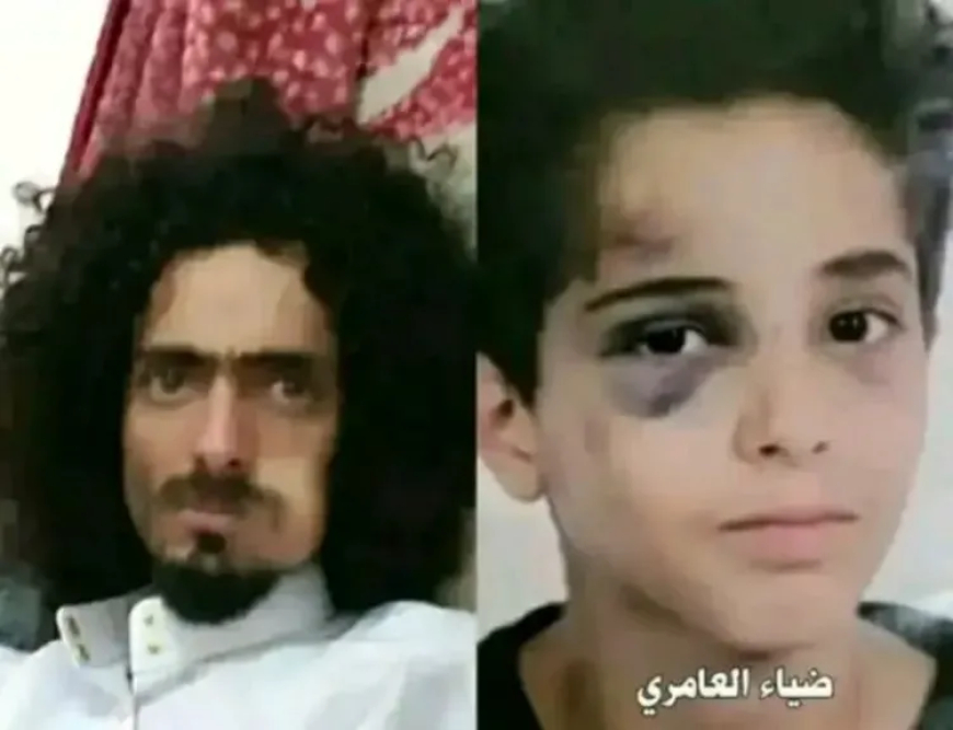 القصة الكاملة.. تحول جريمة اعتداء وحشي على طفل إلى قضية رأي عام بصنعاء
