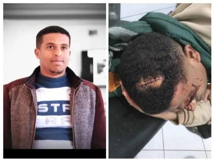 تعز.اعتداء غادر يستهدف الإعلامي محمد الحمادي خلال عودته إلى منزله