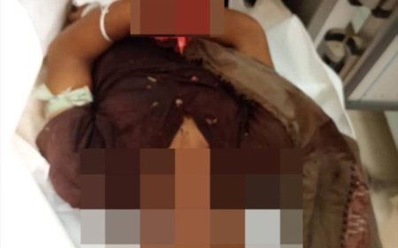 أبين.. مقتل شاب في مديرية لودر جراء إنفجار عبوة ناسفة في منزله